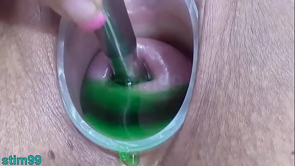 Cervix and Pee Hole Inflation with Injections for Japanese Lesbians